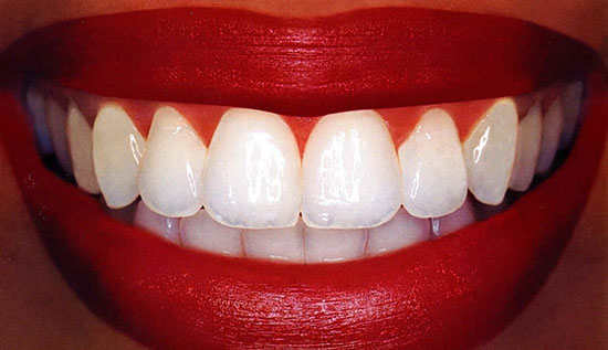 15 фактов о зубах